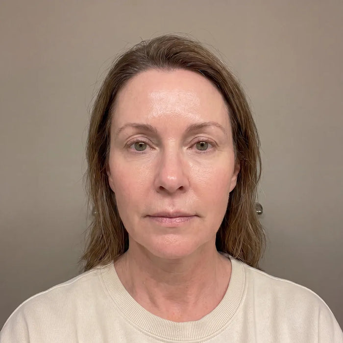 Jennifer after consistent use of Elysium Copper Peptide Renewal Serum
