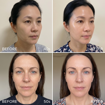 Sculpt Radiance Wand – Face & Neck Firming Tool
